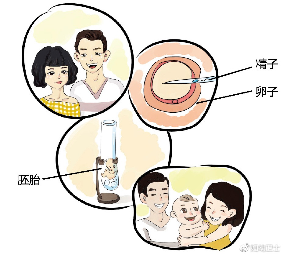 怀孕前