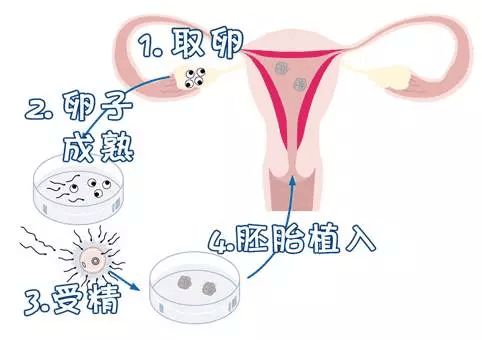 备孕助孕