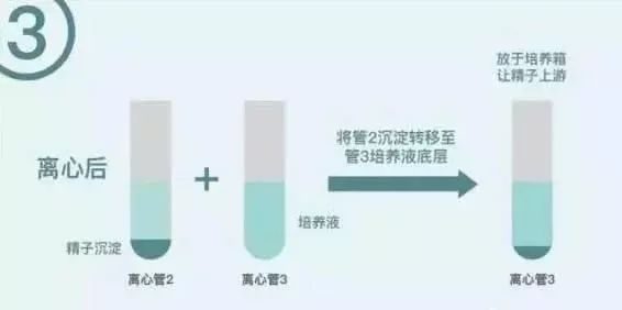 备孕