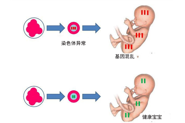 美国生孩子费用