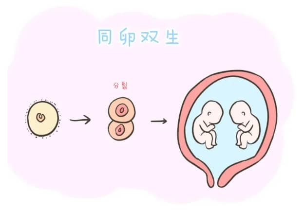多囊卵巢综合征