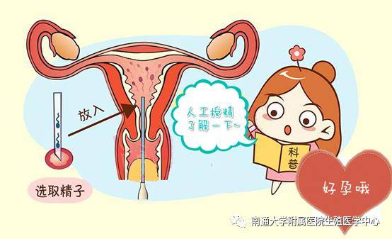 人工授精