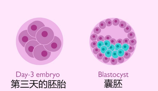 人工助孕