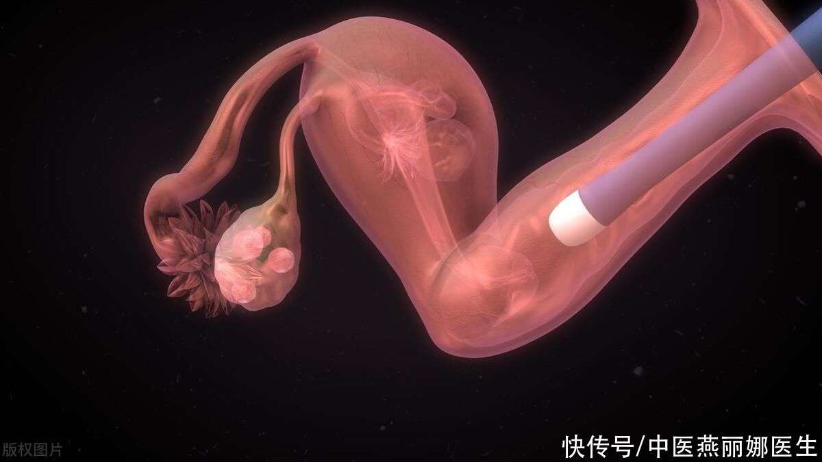 北京捐卵价格