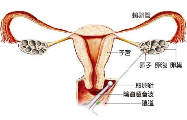 郑州试管医院排名