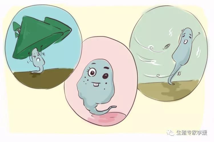 人工取卵